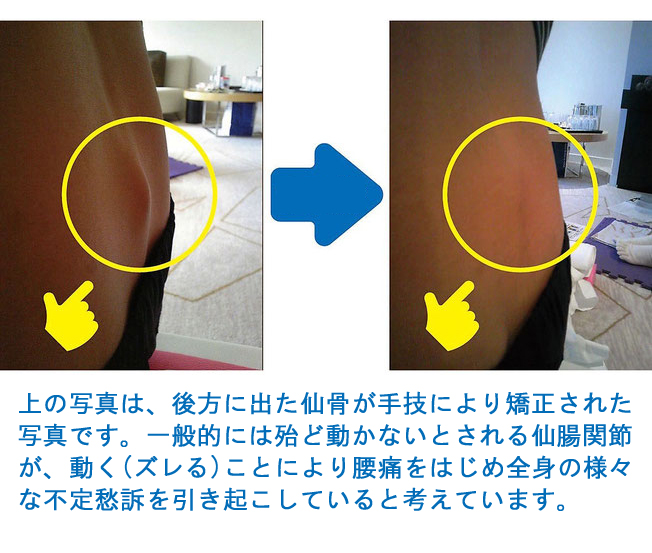 背骨コンディショニングとは 一般社団法人 背骨コンディショニング協会